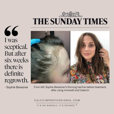 I was sceptical. But after six weeks there is definite regrowth. CALECIM Pro Advanced Hair System