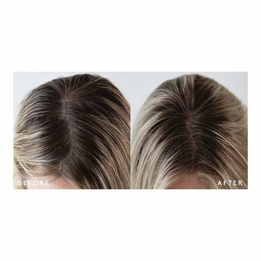 VIRTUE LABS Exfoliating Scalp Treatment 150ml before and after results